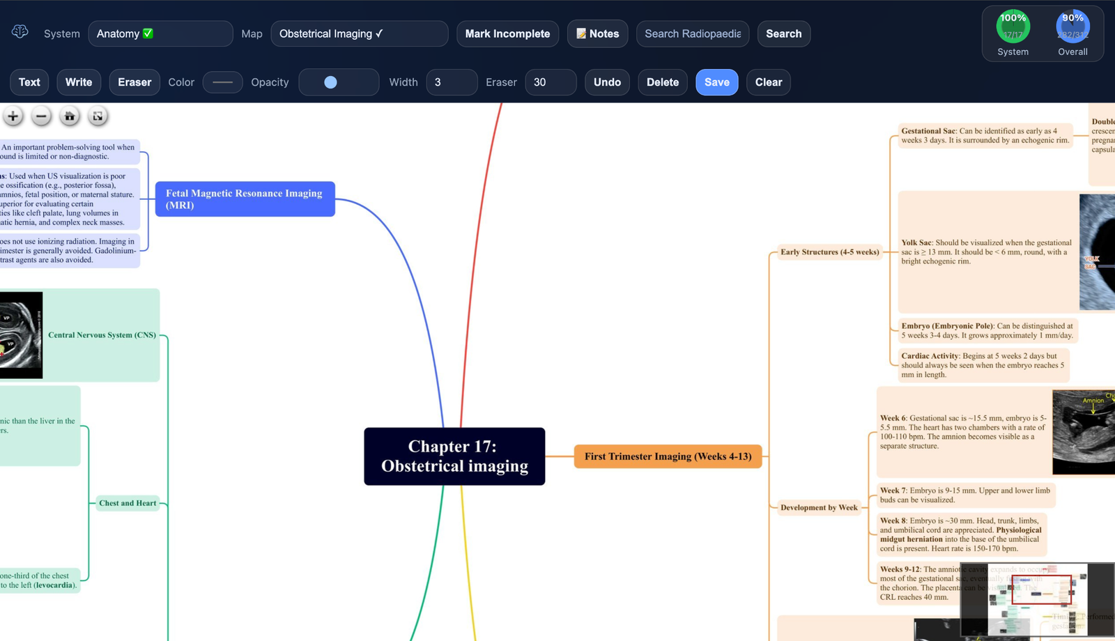 Mindmaps