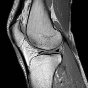 Musculoskeletal radiology