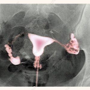 Female reproductive radiology